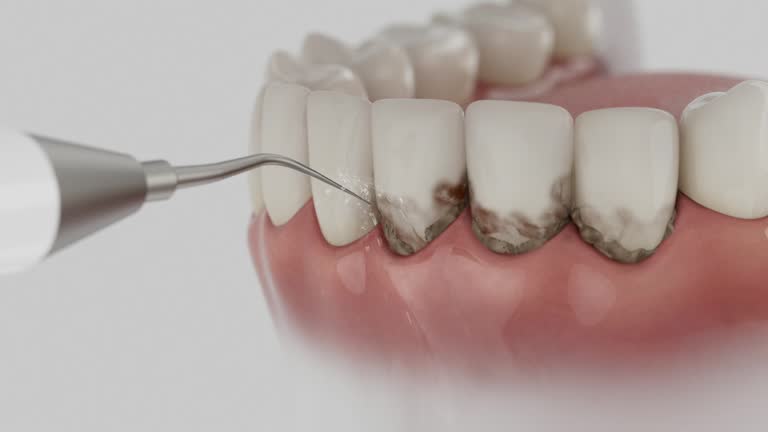 Reliable Dental contractor in Driggs, ID by Smile Center Dentistry